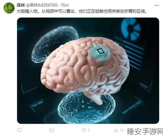 马斯克脑机接口技术再突破，第二例人体移植手术成功，未来游戏交互或迎新变革？